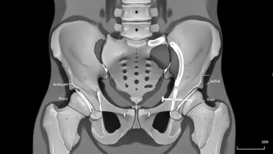 Osteotomia periacetabular